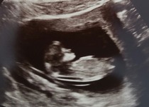 Nub Theorists out there. Girl or boy?