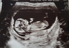 Another guess ifs its a boy/girl post