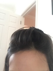 Is anyone brave/confident enough to post a pic of their skin without any make up??
