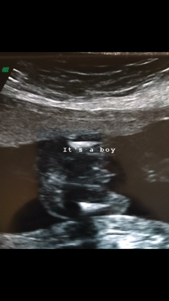 Ultrasound boy?