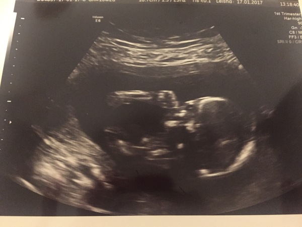 #TTC1 - Second Wave grads thread!