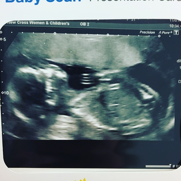 May 2017 #6........ 'Half way there and trips to Mothercare'