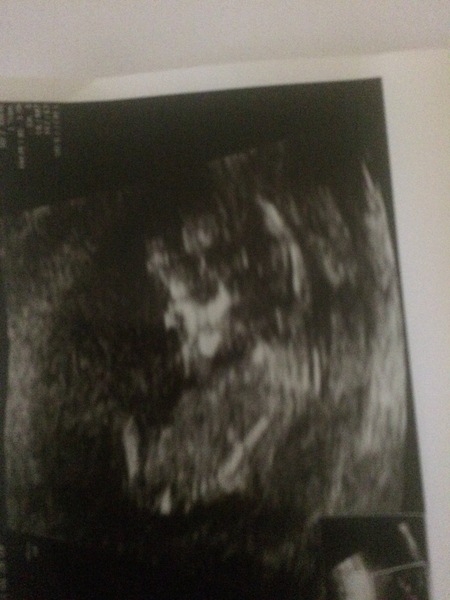 Gender guesses... Pretty please