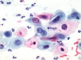 Smear test after chilldbirth