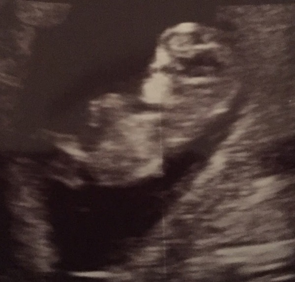 #TTC1 - Second Wave grads thread!