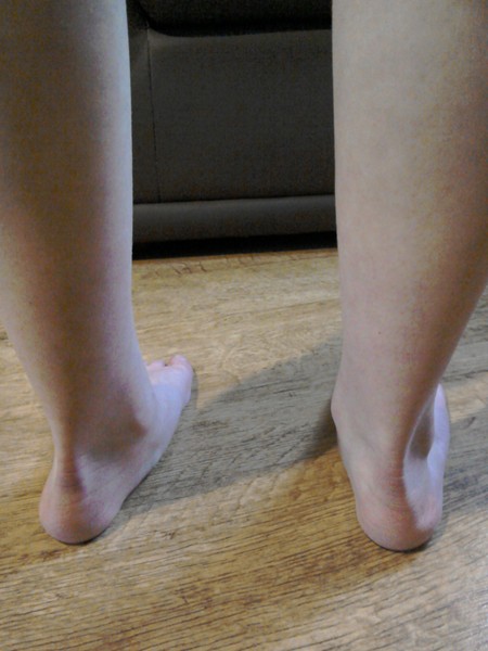 Ds knee ?!