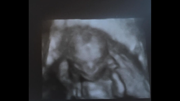 Pregnant at forty and over - thread 3