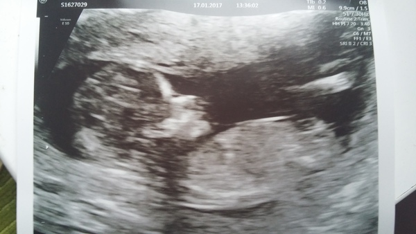 August 2017: the one in which we'll get midwife appointment