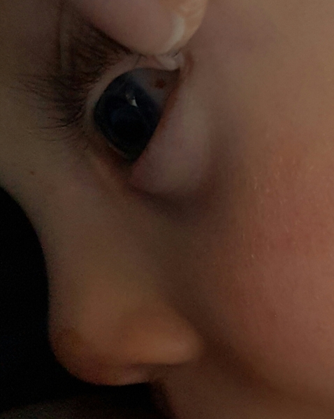 Babys eye
