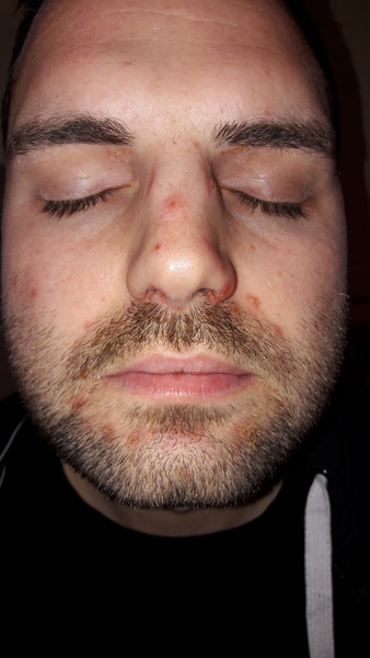 Husband feeling unwell. Advice off any docs? (photos inc)