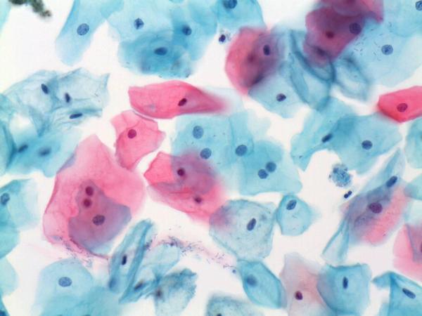 Smear test after chilldbirth