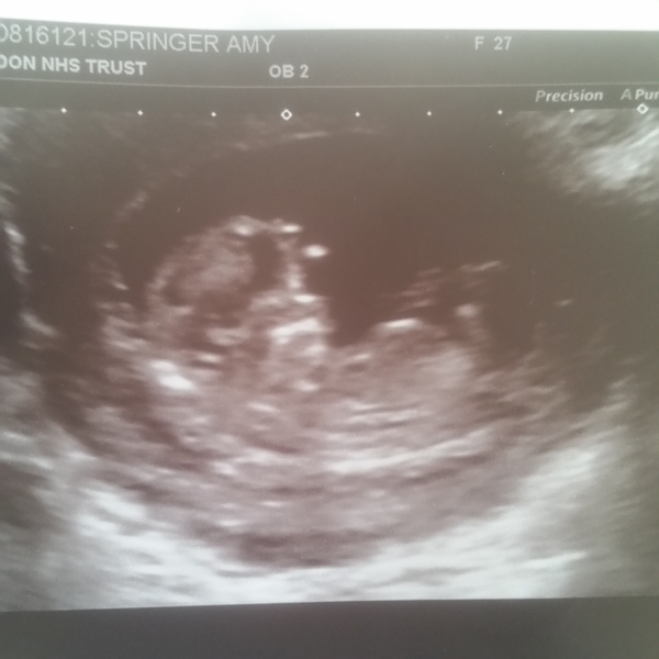 Another guess the gender! Didnt think I wanted to find out but have changed my mind ...
