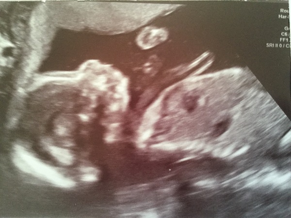 May 2017 #6........ 'Half way there and trips to Mothercare'