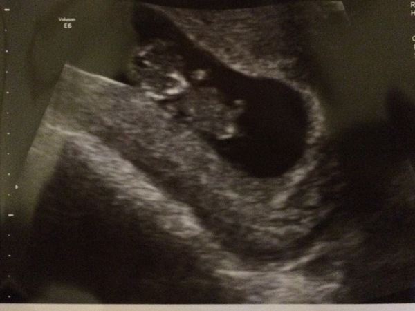 August 2017: the one in which we'll get midwife appointment