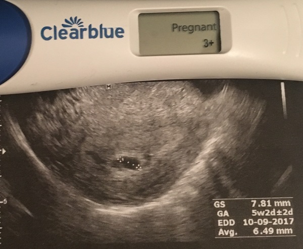 Need support- 2wk wait for termination