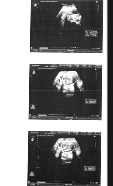 Can anyone work out my 20 week scan images?