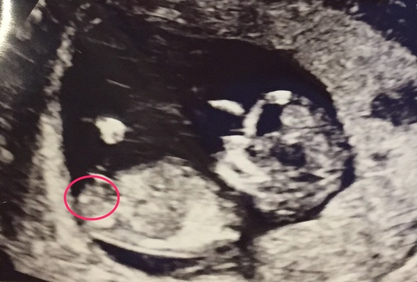 Gender guess nub/skull theory?