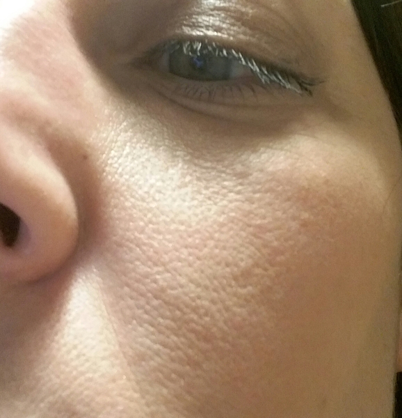 What skin type do I have, and how can I make it better!