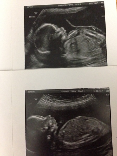 Due in June, 12 week scans happening and coming up!