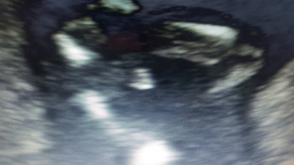 Baby gender 16weeks boy or girl?!?!