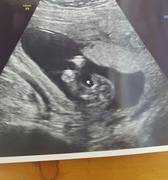 Gender scan accurate?