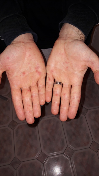 Husband feeling unwell. Advice off any docs? (photos inc)