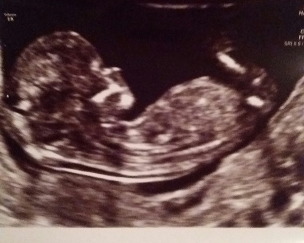 Another gender guess