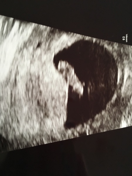 Staying posifrickentive- Thread 14 for ladies pg after mc