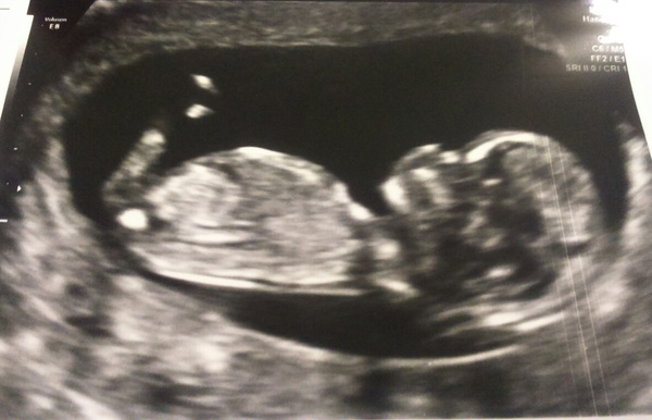Gender guesses... Pretty please