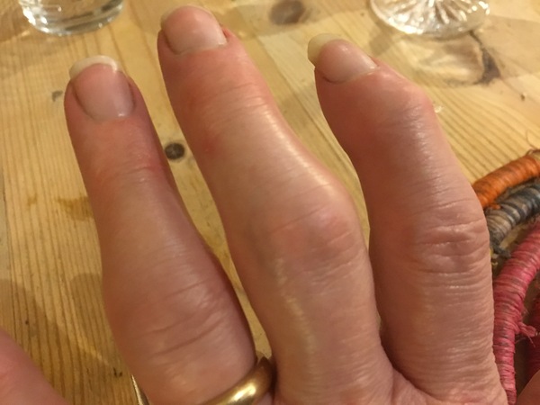 Zombie and Woolly Hugs. Our second thread! Come and find out about Candy's Hugs, all very welcome.