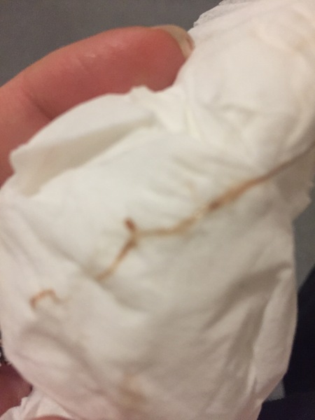 implantation bleed??? *TMI* help!