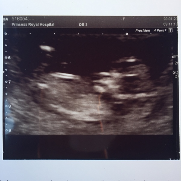 First scan