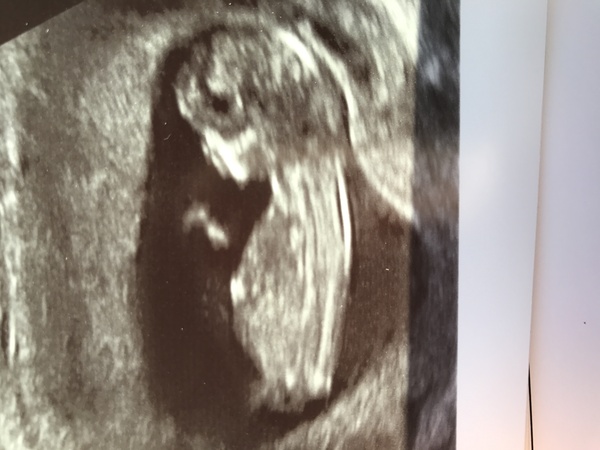 12 week scan any guesses :) x