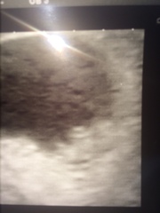 Would love to see scan pics from about 9+5