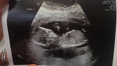 Gender guess anyone??