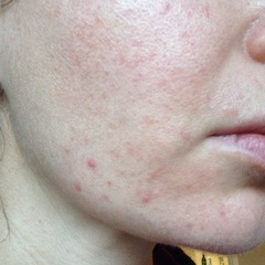 Yet More Fantastic Skincare and Where To Find It
