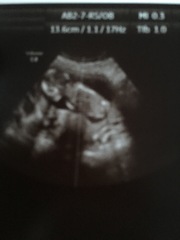 Any guesses?