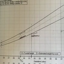 Twin 2 weight issues