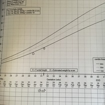 Twin 2 weight issues