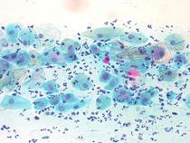 Smear test after chilldbirth