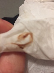 implantation bleed??? *TMI* help!