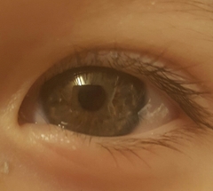 Toddler eye colour