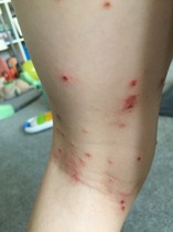 On going skin problems + new spots