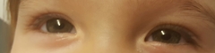 Toddler eye colour