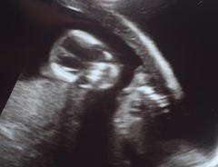Scan pic skull theory - boy or girl?