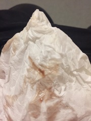 implantation bleed??? *TMI* help!