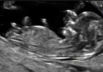 Nub gender-guess help?