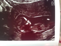 To buy stuff on a 70% chance our baby is a girl!?