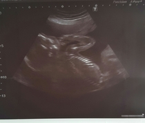 Staying posifrickentive- Thread 13 for ladies pg after mc