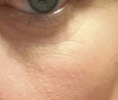 What skin type do I have, and how can I make it better!